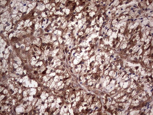 LGALS3 / Galectin 3 Antibody (clone OTI7G9)