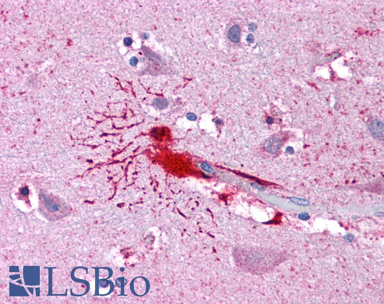 IHC-plus™ LHX8 Antibody