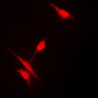 Polyclonal Rabbit anti-Human HDAC10 Antibody (N-Terminus, IHC, IF, WB)