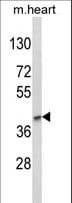 Polyclonal Rabbit anti-Human LMX1B Antibody (aa175-202, IHC, WB)