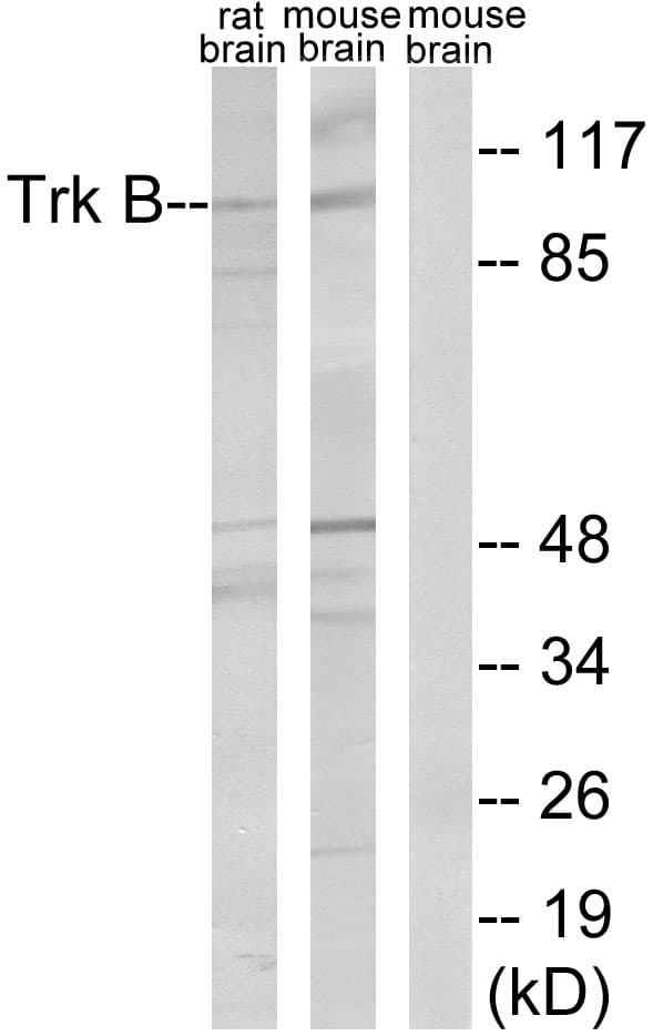 IHC-plus™ Polyclonal Rabbit anti-Human NTRK2 / TRKB Antibody (aa481-530, IHC, WB)
