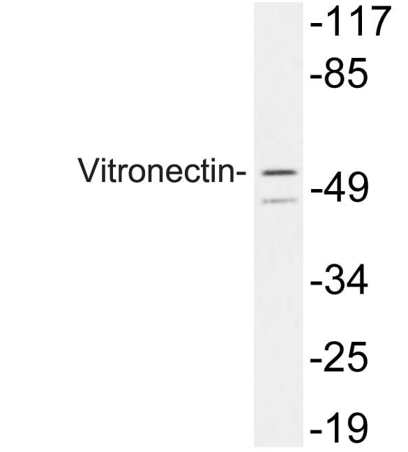 Polyclonal Rabbit anti-Human VTN / Vitronectin Antibody (aa209-258, WB)