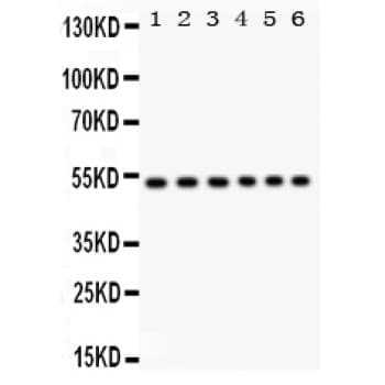 Polyclonal Rabbit anti-Human ULK3 Antibody (aa427-454, IHC, WB)