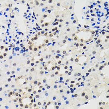 Polyclonal Rabbit anti-Human CIRP / CIRBP Antibody (IHC, IF, WB)