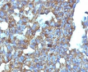 CD99 Antibody (clone MIC2/877, Ready-to-Use)