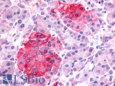 PathPlus™ SSTR1 Antibody (N-Terminus)