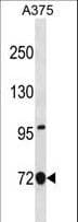 Polyclonal Rabbit anti-Human ANXA6/Annexin A6/Annexin VI Antibody (aa147-175, WB)