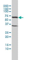 IHC-plus™ TCP1 Antibody (clone 2B2-D6)