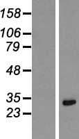 KRCC1 Protein (Over-Expression Lysate Myc-DDK (Flag))