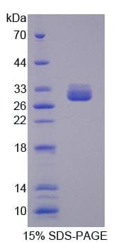 Human MUT / MCM Protein (Recombinant His, N-Terminal)