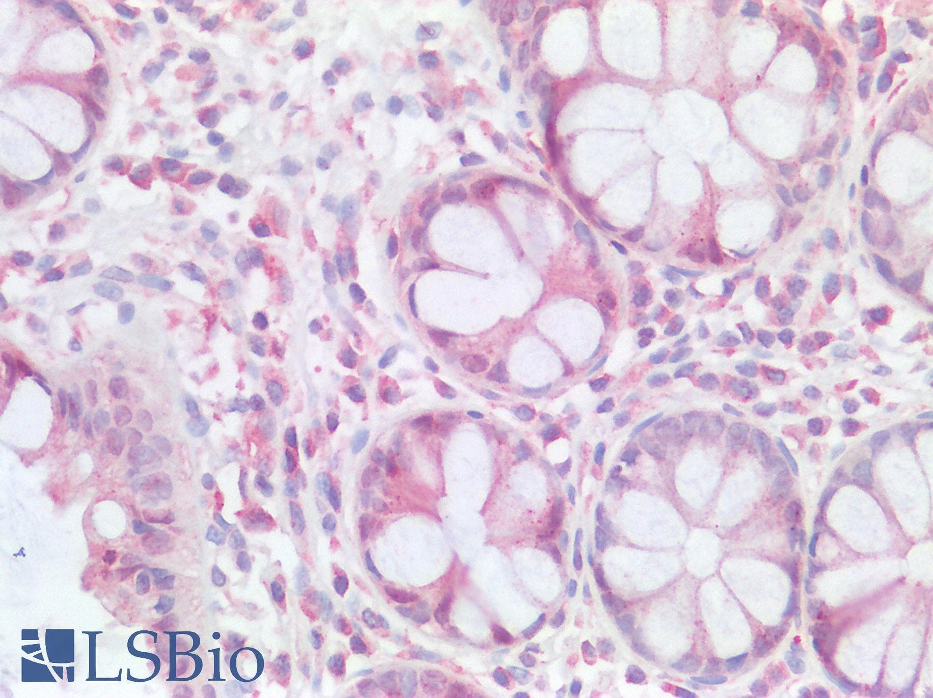 CD163L1 / SCART1 Antibody