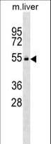VRK2 Antibody (aa354-381)