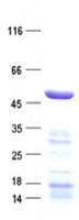 Human METTL15 / METT5D1 Protein (Recombinant His, N-Terminal)