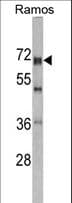 DDX5 Antibody (aa306-334)