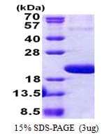 Human IL1F10 Protein (Recombinant His)