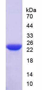 Bovine IFN Beta / Interferon Beta Protein (Recombinant His-T7)