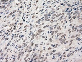 Monoclonal Mouse anti-Human CYPOR / POR Antibody (clone OTI3F10, IHC, IF, WB)