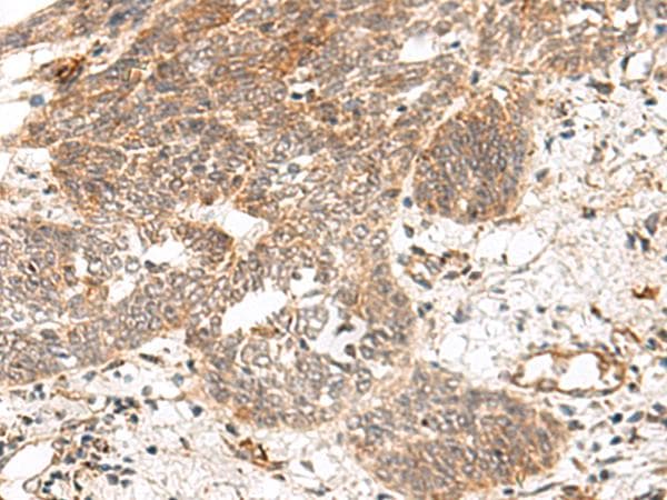 GRASP Antibody