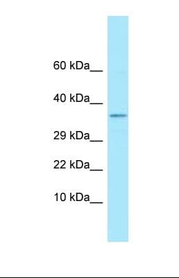 FCER2 / CD23 Antibody (C-Terminus)