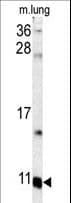 S100A6 / Calcyclin Antibody (aa37-67)