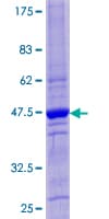 Human CST4 / Cystatin S Protein (Recombinant GST)