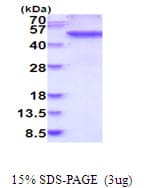 Human FGG / Fibrinogen Gamma Protein (Recombinant His)