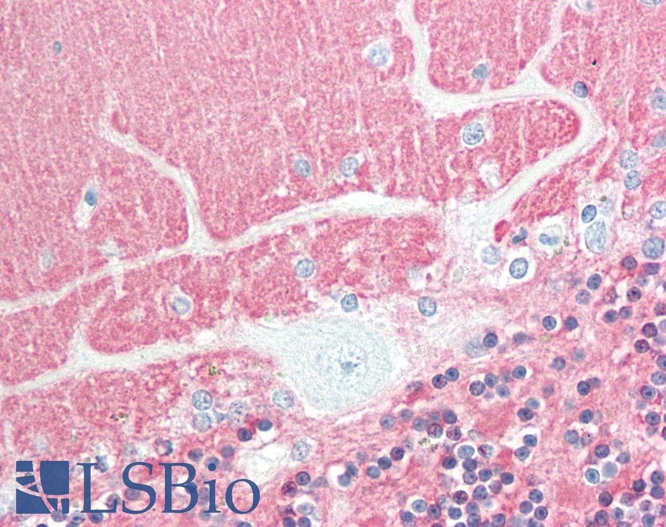 IHC-plus™ VILIP / VSNL1 Antibody