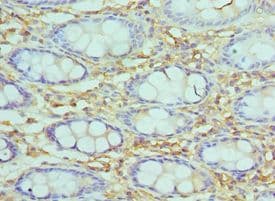Polyclonal Rabbit anti-Human SMARCC2 Antibody (aa300-650, IHC, WB)