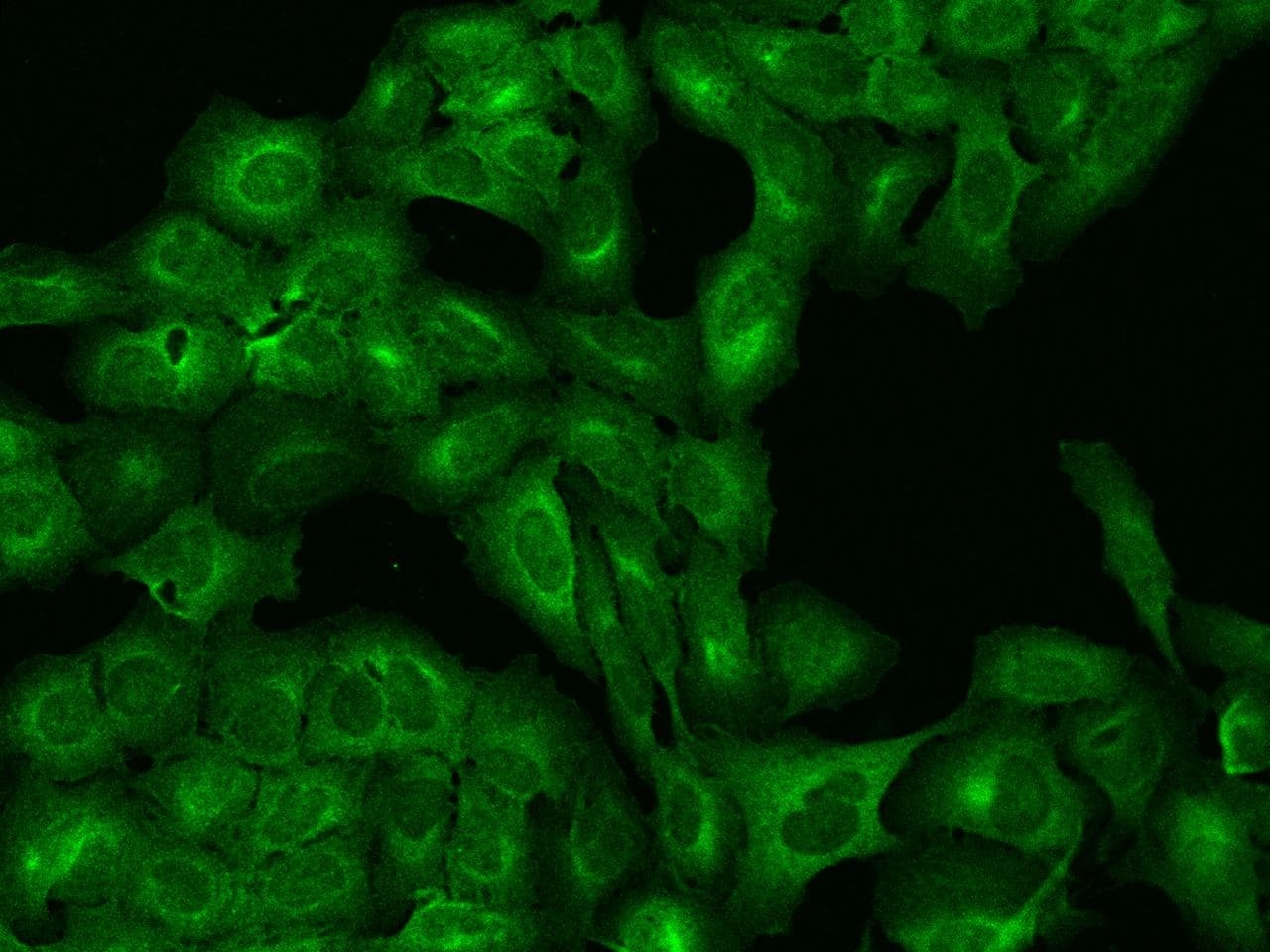 Polyclonal Rabbit anti-Human VTA1 Antibody (IF, WB)