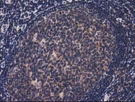 ACOT12 Antibody (clone OTI1B9)
