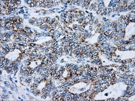 ATP5B / ATP Synthase Beta Antibody (clone OTI7F4)