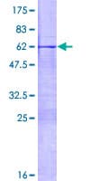 Human MSX1 Protein (Recombinant GST)