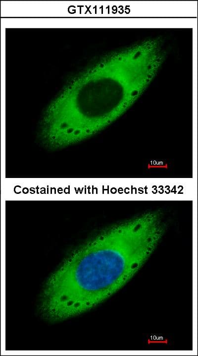 RPS3A / Ribosomal Protein S3A Antibody
