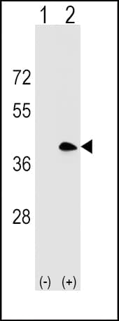 Polyclonal Rabbit anti-Human CD20 Antibody (aa216-244, WB)