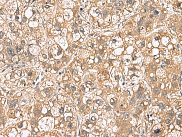 PTPRS Antibody