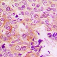 PAK1 Antibody