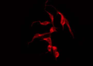 Polyclonal Rabbit anti-Human CDH9 / Cadherin 9 Antibody (IHC, IF, WB)