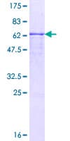 Human SMPDL3B Protein (Recombinant GST)
