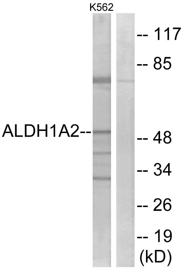 IHC-plus™ RALDH2 / ALDH1A2 Antibody (aa412-461)