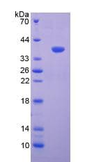 Human VCAN / Versican Protein (Recombinant His, N-Terminal)