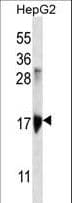 KRTAP1-3 Antibody (aa88-117)