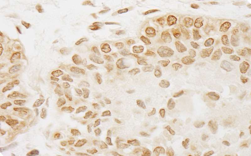 PPP5C Antibody (aa1-50)