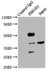 Polyclonal Rabbit anti-Human PIH1D1 Antibody (IHC, WB)
