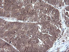 MAP2K3 / MEK3 / MKK3 Antibody (clone OTI6B11, Carrier-free)