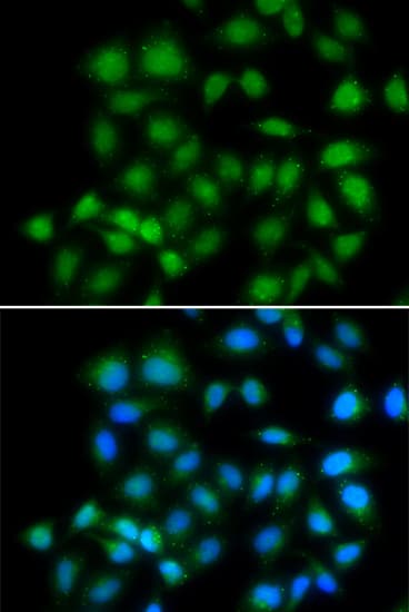 MXI1 / MAD2 Antibody