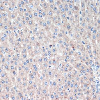 LRRK2 Antibody