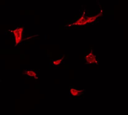 Polyclonal Rabbit anti-Human MN1 Antibody (IF, WB)