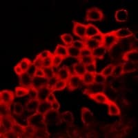 Polyclonal Rabbit anti-Human BAX Antibody (C-Terminus, IF, WB)