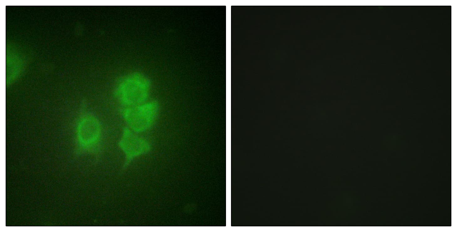 IHC-plus™ RPS6KA5 / MSK1 Antibody (aa551-600)