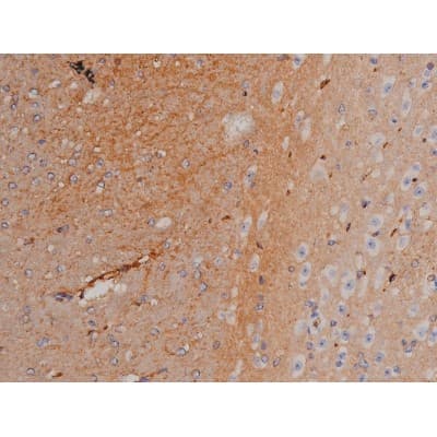 SYN / FYN Antibody (phospho-Tyr530)